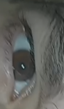 eye area.PNG
