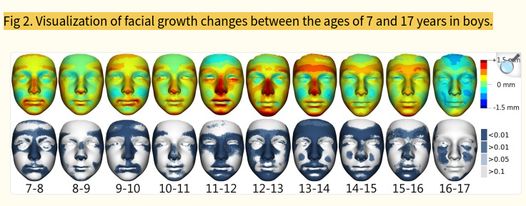  Simulation of facial growth based on longitudinal data Age progression and age regression bet...png