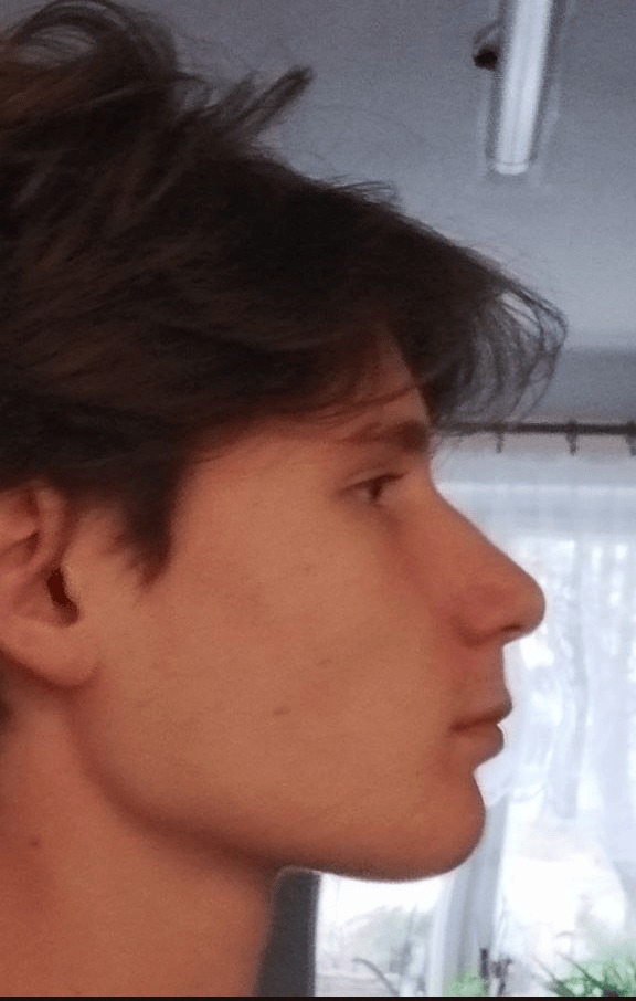 ezgif.com-speed (1).gif