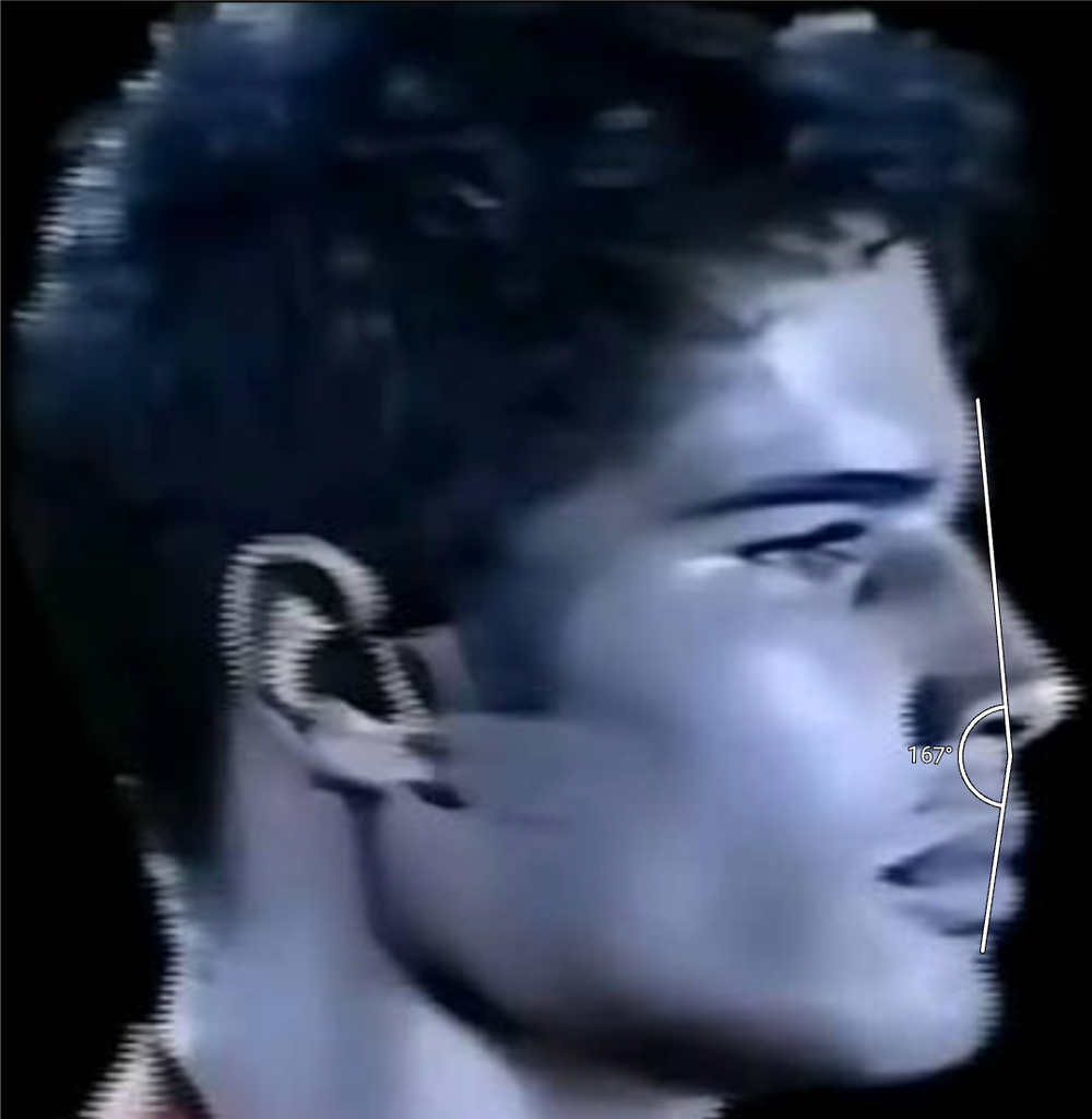 facial convexity.png