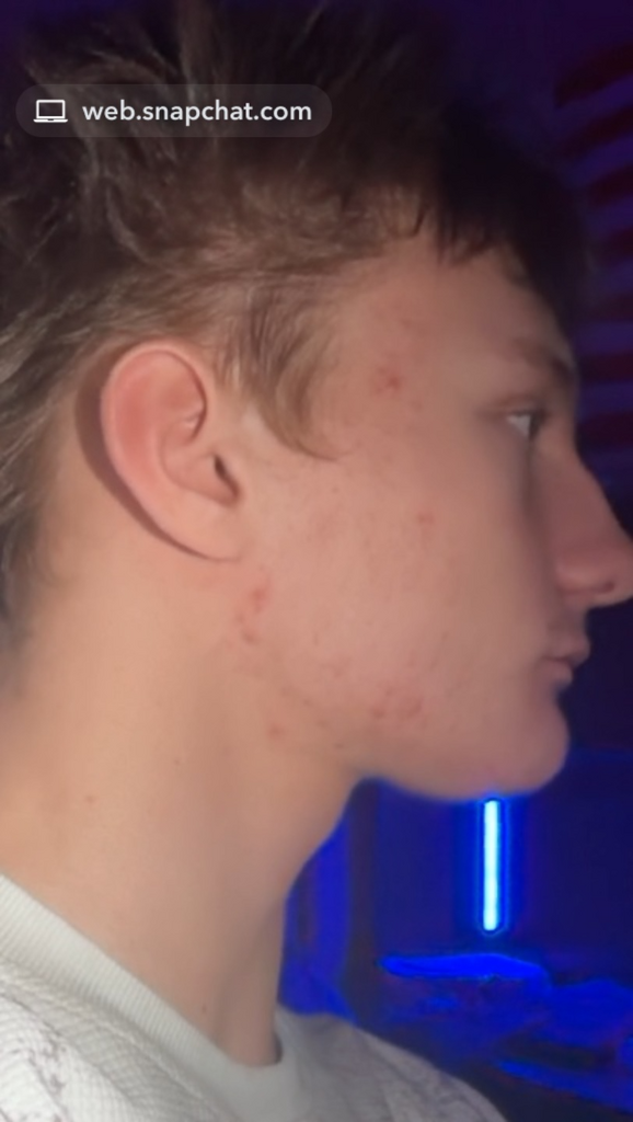 Snapchat for Web 2026-2-26 at 9_27_26 PM.png