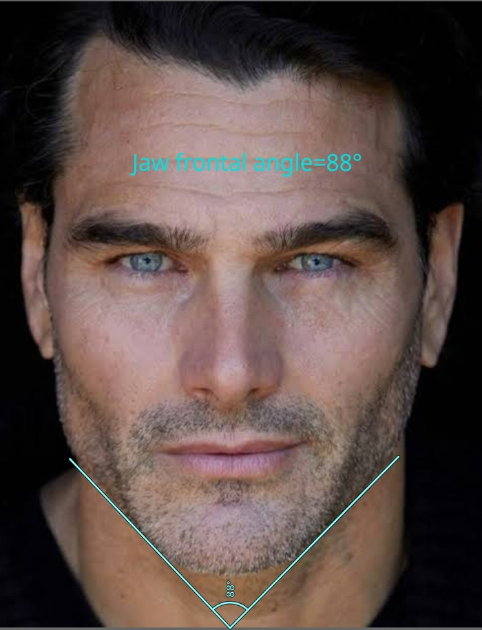 jaw frontal angle.jpg